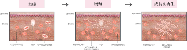 炎症　増殖　成長＆再生