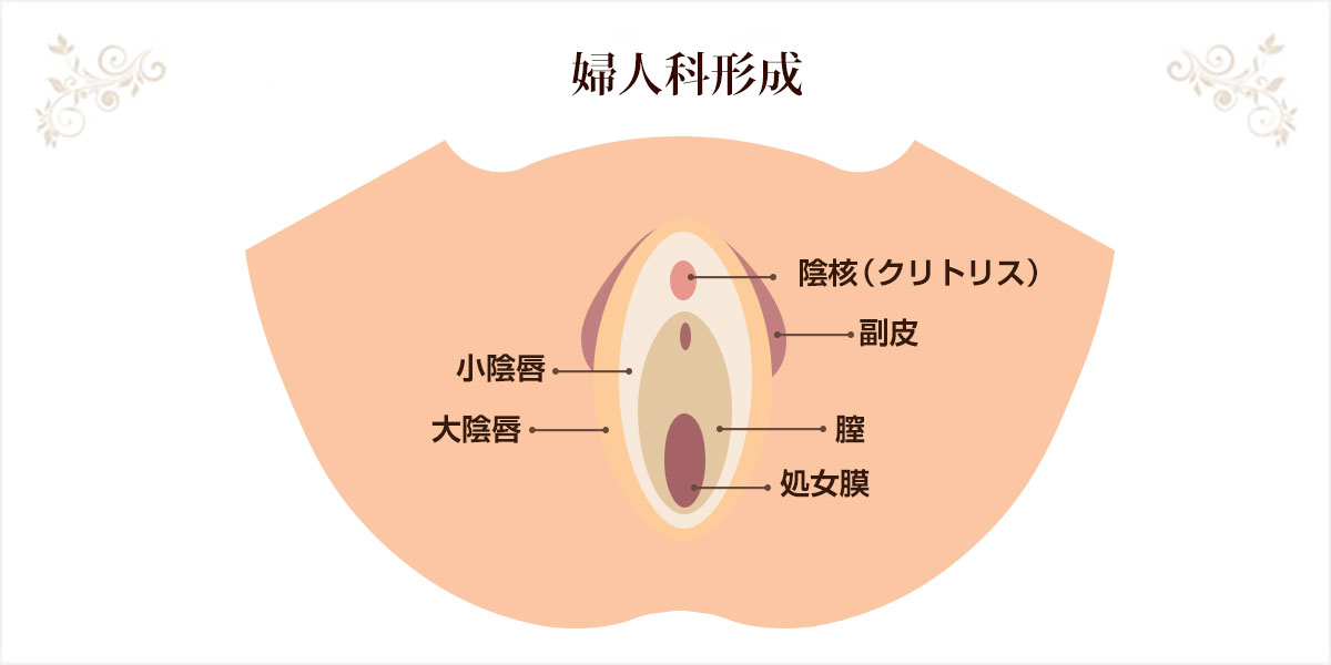 婦人科形成の説明図